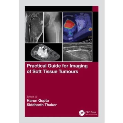 Practical Guide for Imaging of Soft Tissue Tumours (häftad, eng)