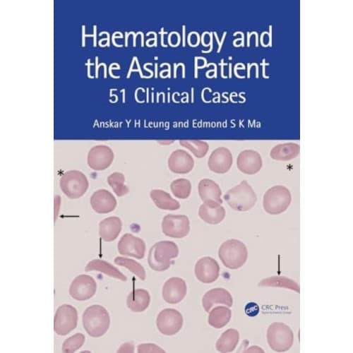 Haematology and the Asian Patient (häftad, eng)