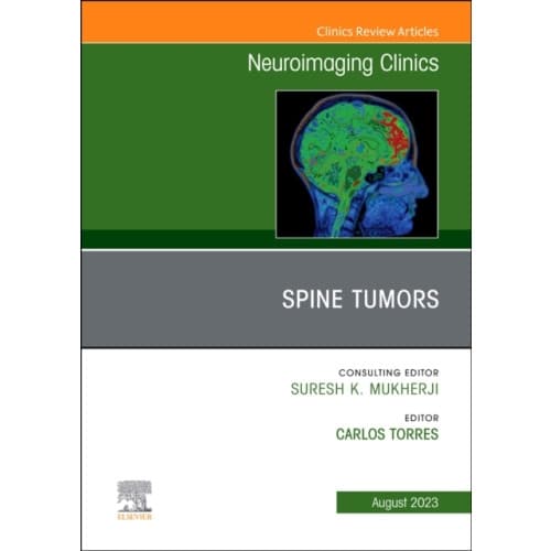 MRI and Traumatic Brain Injury, An Issue of Neuroimaging Clinics of North America (inbunden, eng)