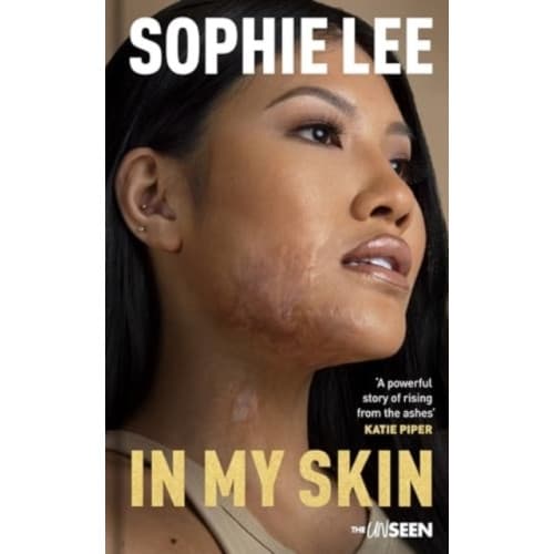 In My Skin (inbunden, eng)