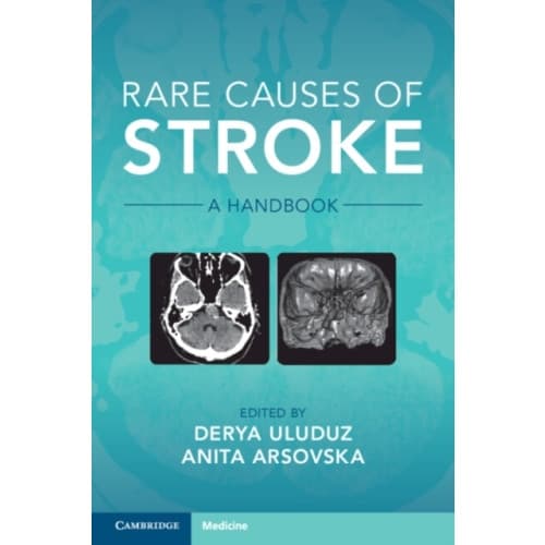Rare Causes of Stroke (häftad, eng)