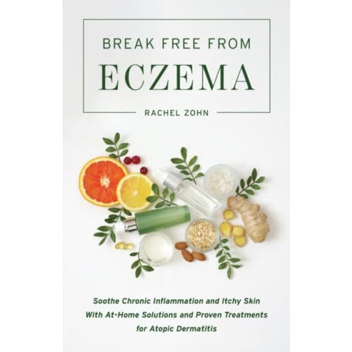 Break Free From Eczema (häftad, eng)