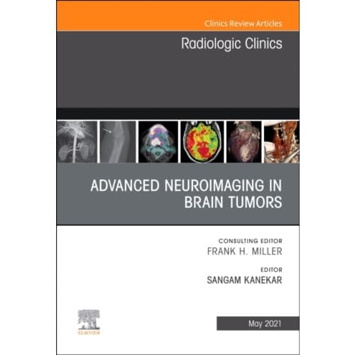Advanced Neuroimaging in Brain Tumors, An Issue of Radiologic Clinics of North America (inbunden, eng)