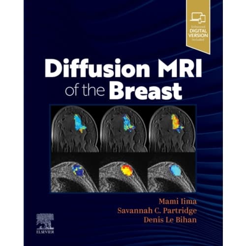Diffusion MRI of the Breast (häftad, eng)
