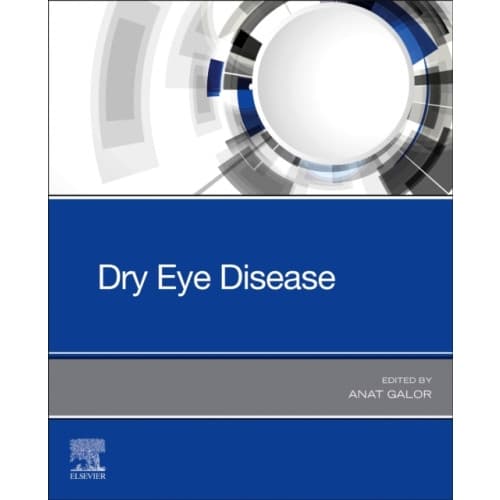 Dry Eye Disease (häftad, eng)