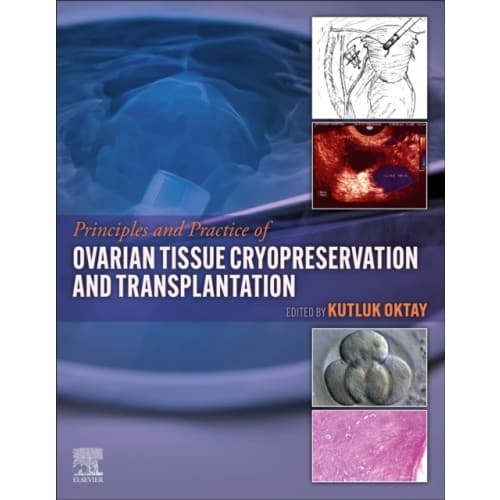 Principles and Practice of Ovarian Tissue Cryopreservation and Transplantation (inbunden, eng)