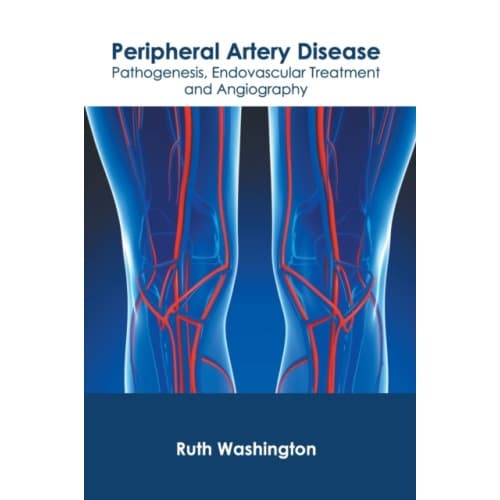 Peripheral Artery Disease: Pathogenesis, Endovascular Treatment and Angiography (inbunden, eng)