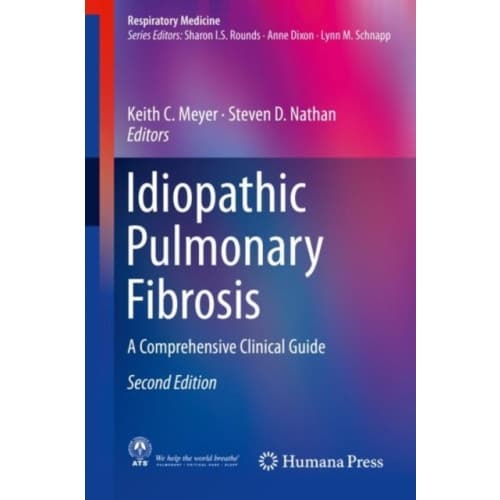 Idiopathic Pulmonary Fibrosis (inbunden, eng)