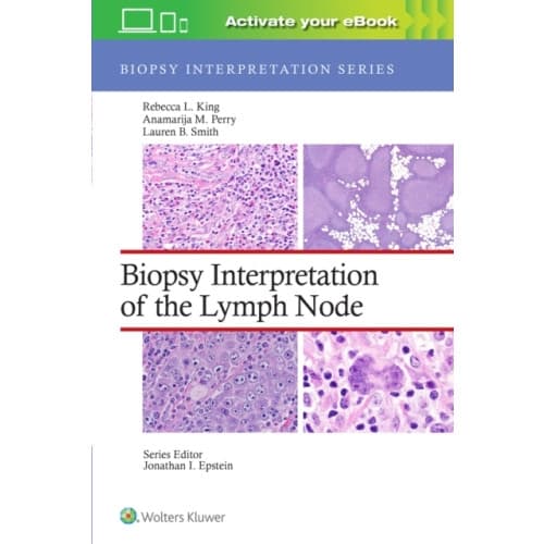 Biopsy Interpretation of the Lymph Node: Print + eBook with Multimedia (inbunden, eng)