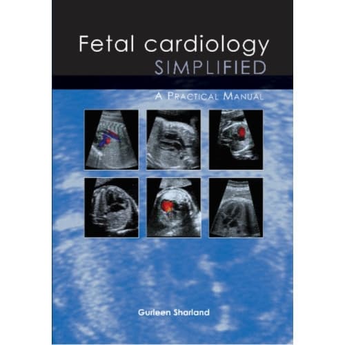 Fetal Cardiology Simplified (häftad, eng)