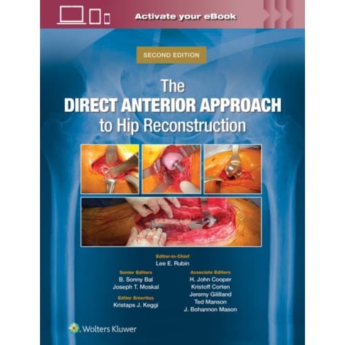 The Direct Anterior Approach to Hip Reconstruction (inbunden, eng)