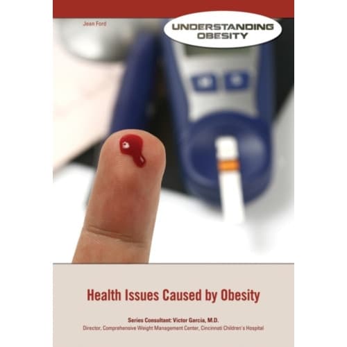 Health Issues Caused by Obesity (inbunden, eng)