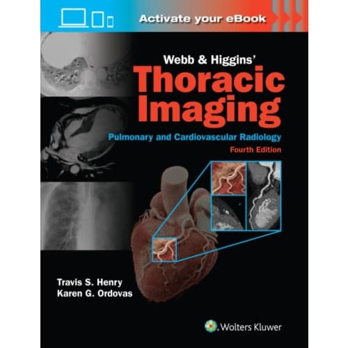 Webb & Higgins Thoracic Imaging: Print + eBook with Multimedia (inbunden, eng)