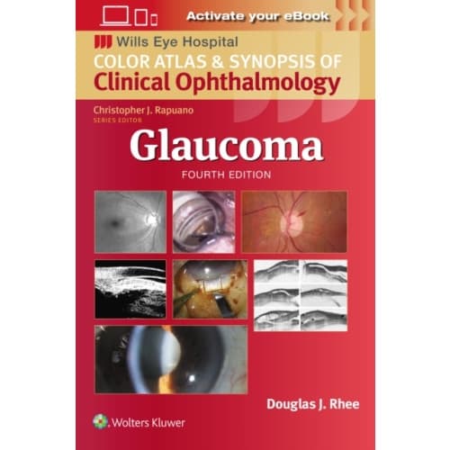 Glaucoma (häftad, eng)