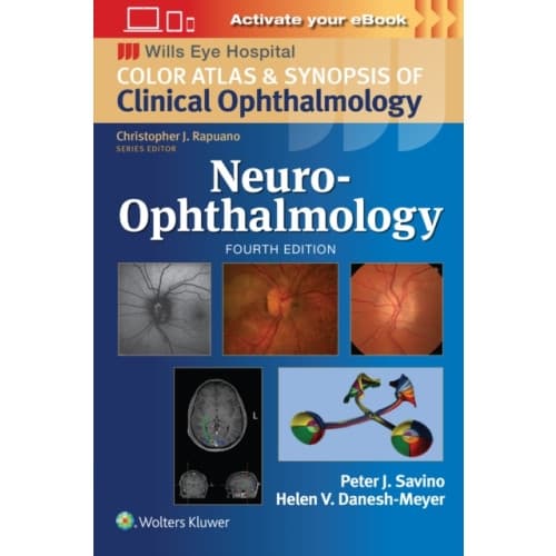 Neuro-Ophthalmology: Print + eBook with Multimedia (häftad, eng)