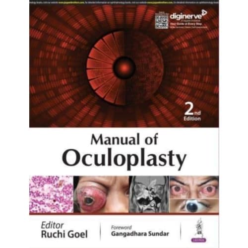Manual of Oculoplasty (häftad, eng)