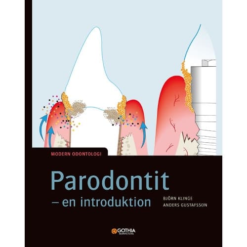 Parodontit : en introduktion (häftad)