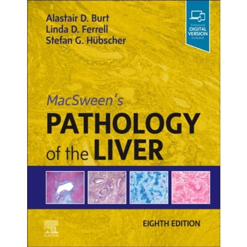MacSween's Pathology of the Liver (inbunden, eng)