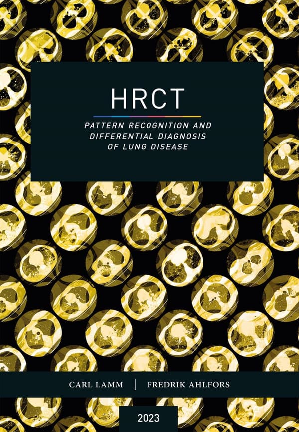 Hrct - Pattern Recognition And Differential Diagnosis Of Lung Disease (Bok)
