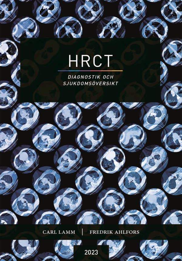 Hrct - Diagnostik Och Sjukdomsöversikt (Bok)