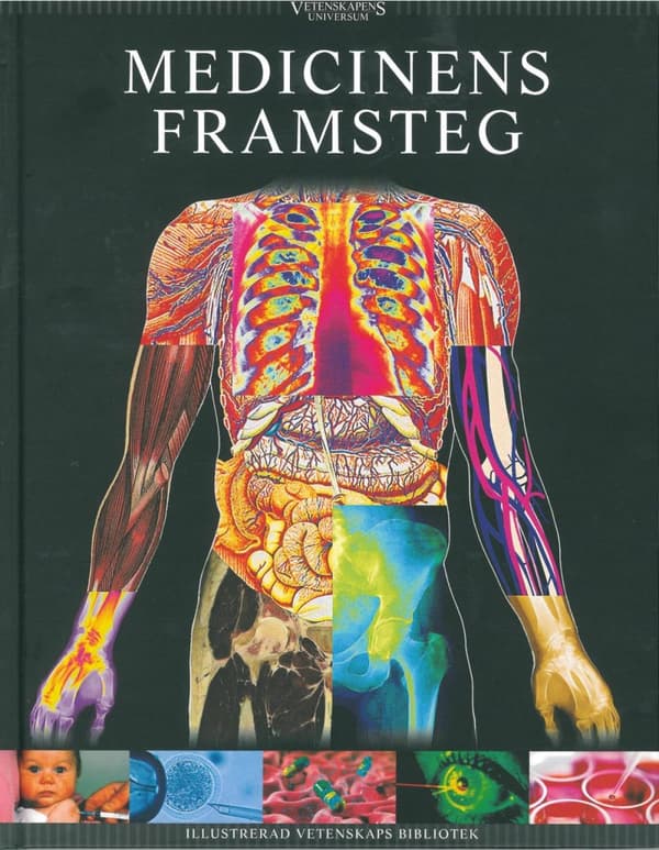 Vetenskapens Universum. Medicinens Framsteg (Bok)