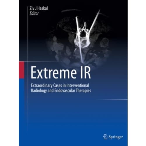 Extreme IR (inbunden, eng)