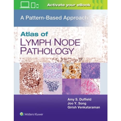 Atlas of Lymph Node Pathology (inbunden, eng)