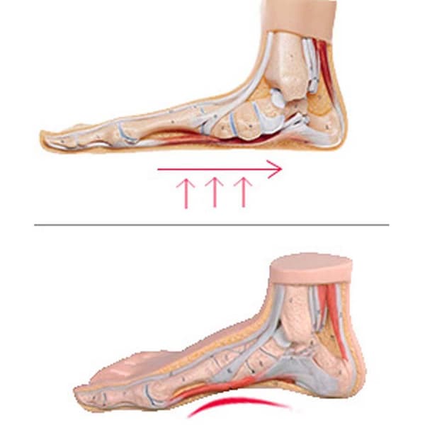 Mjuka Lindrande Geleinlägg Arch Support