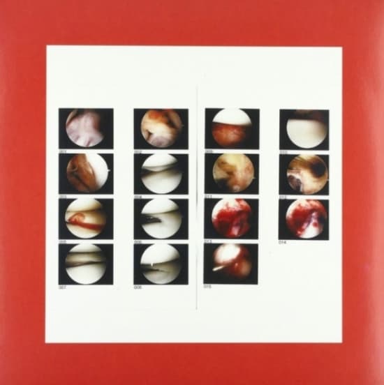 Cradle - Laughing In My Sleep (LP)