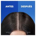 Miniatyrbilde 7 av 8: Sjampo Head & Shoulders H&S Clásico 1 L