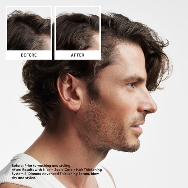 Nioxin System 2 Loyalty Kit for Thinning Hair - Fint & Volym