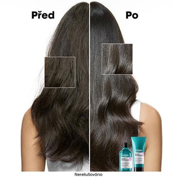 Schampo för känslig hårbotten Scalp Advanced Anti-Discomfort Dermo (reglerande schampo) - Volym: 300 ml