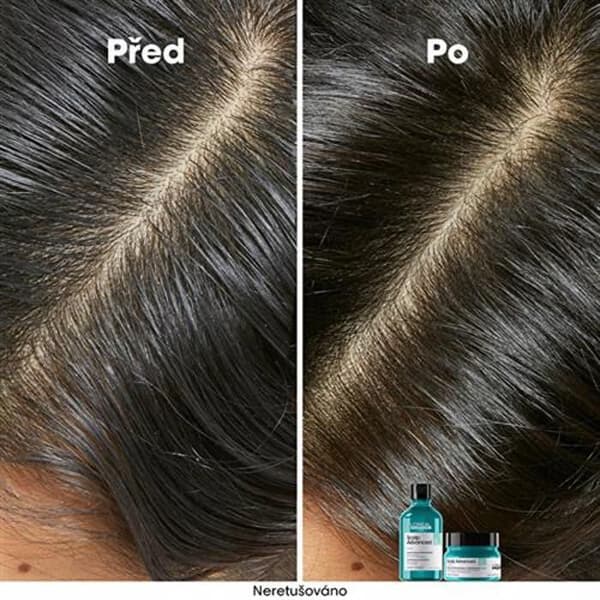 Schampo för känslig hårbotten Scalp Advanced Anti-Discomfort Dermo (reglerande schampo) - Volym: 300 ml