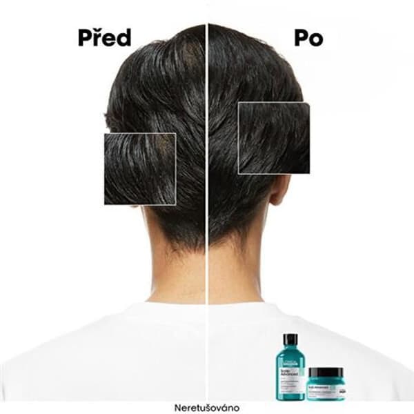 Schampo för känslig hårbotten Scalp Advanced Anti-Discomfort Dermo (reglerande schampo) - Volym: 300 ml