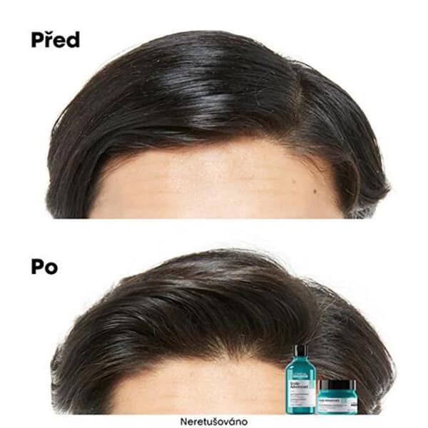 Schampo för känslig hårbotten Scalp Advanced Anti-Discomfort Dermo (reglerande schampo) - Volym: 300 ml