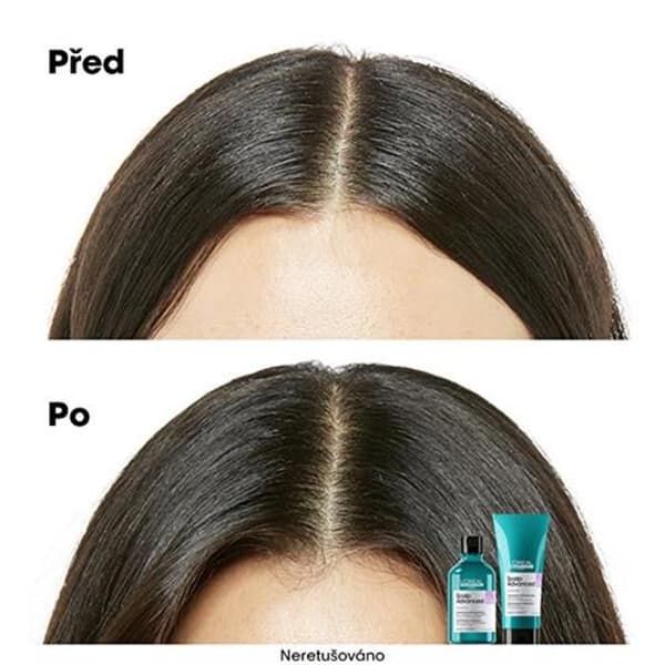 Schampo för känslig hårbotten Scalp Advanced Anti-Discomfort Dermo (reglerande schampo) - Volym: 300 ml