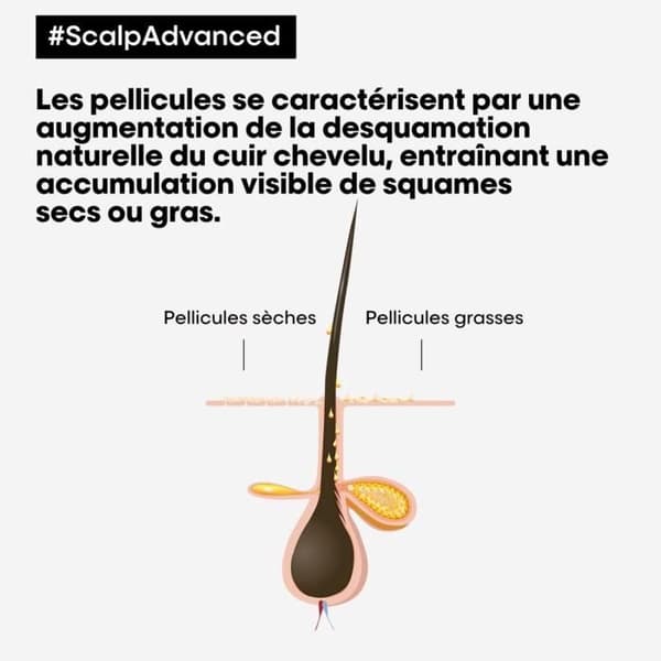 L'Oréal Scalp Advanced Anti-Mjällschampo 500ml