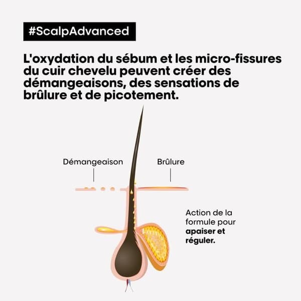 L'Oréal Scalp Advanced Anti-Oscomfort Schampo 500ml