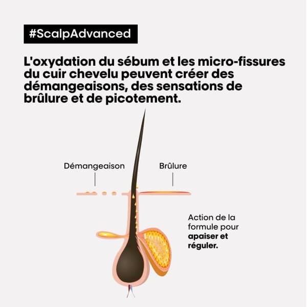 L'Oréal Scalp Advanced 2-i-1 Clay 250ml