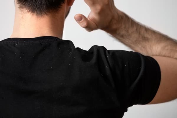 DX2 schampo för män MOT HÅRFALL 150 ML
