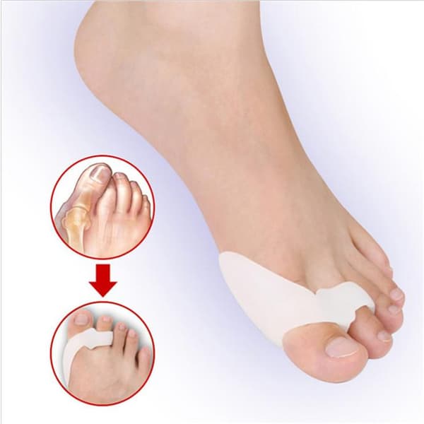 Silikone tommelfingerkorrektor, hallux valgus separator - hvid og kødfarvet