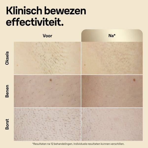 Braun IPL hårfjerningsenhed Silk-expert Pro PL5242 (PL5242)