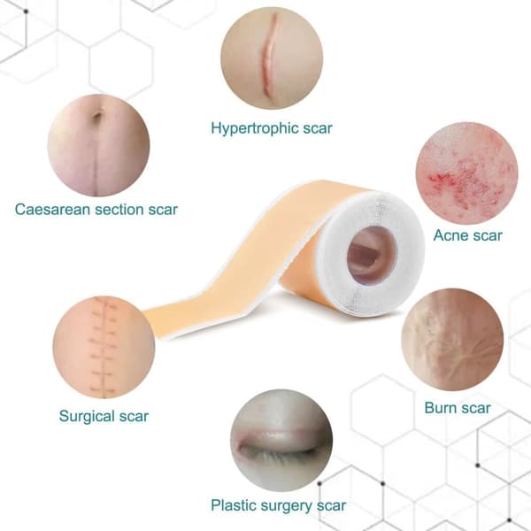 Silikonetape / Plastre til Ar - Treat Scars