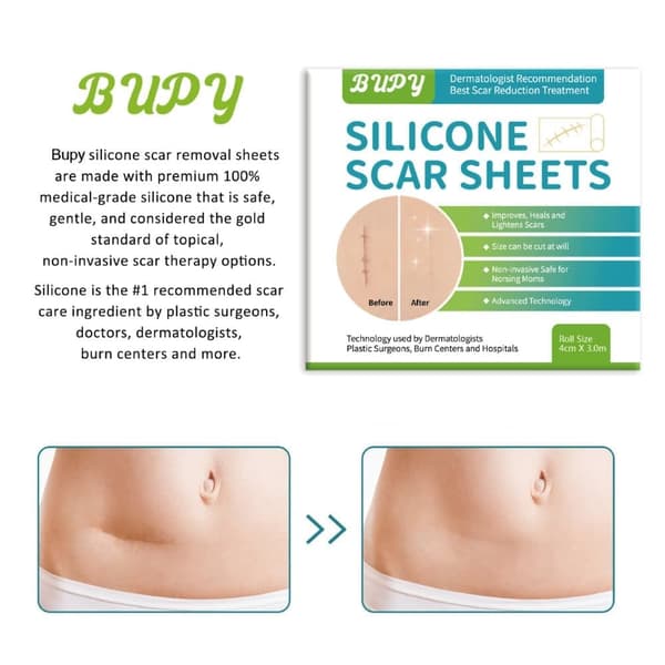 Silikonetape / Plastre til Ar - Treat Scars