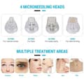 Miniatyrbild 2 av 2: Professionell microneedling-enhet, flera microneedlehuvuden, hållbar metallkonstruktion,50 tillbehör