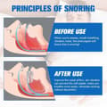 Miniatyrbild 5 av 8: Auledio Anti-Snarkanordningar, Snarkningslösning Stoppa Snarkningsanordningar Snarkskydd, Förhindra Bruxism Och Snarkmunstycke