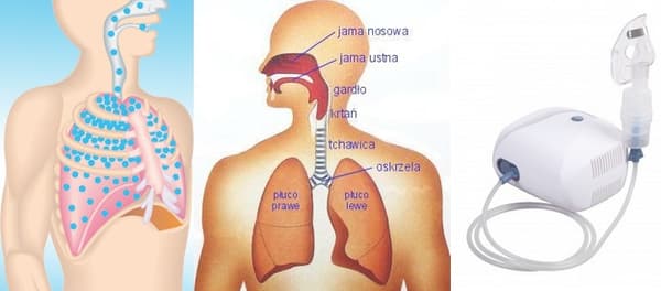 DIAGNOSTIC Nano -kompressori-inhalaattori 1 kpl.