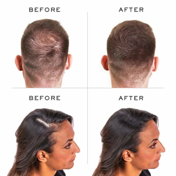 Nanogen - 62030 - Nanofiber 15 G Black Hair Powder