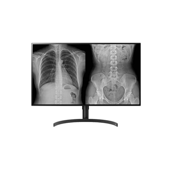 LG 32HL512D-B
