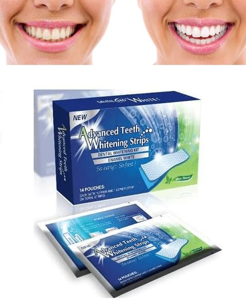 Tandblekning - Dental 360 Whitening Strips (30-pack)